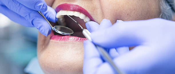 Best Emergency Tooth Extraction in Rouses Point, NY